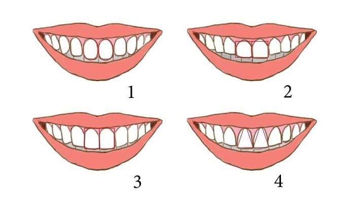 다음 속 그림에 제시돼 있는 치아 모양들 중에서 내 치아와 실제 일치한 것은 몇 번입니까?